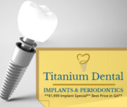TITANIUM DENTAL Implants &amp; Periodontics **$1,999 Implant Special** Best Price in GA!